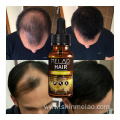 Anti Hair Loss Boosting Hair Growth Serum